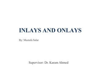 INLAYS AND ONLAYS
By: Mustafa Salar
Supervisor: Dr. Karam Ahmed
 