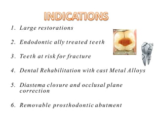 1. Large restorations
2. Endodontic ally treated teeth
3. Teeth at risk for fracture
4. Dental Rehabilitation with cast Metal Alloys
5. Diastema closure and occlusal plane
correction
6. Removable prosthodontic abutment
 