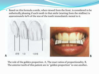  Based on this formula a smile, when viewed from the front, is considered to be
  esthetically pleasing if each tooth in that smile (starting from the midline) is
  approximately 60% of the size of the tooth immediately mesial to it.




 The rule of the golden proportion. A, The exact ratios of proportionality. B,
 The anterior teeth of this patient are in "golden proportion" to one another.
 