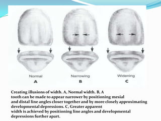 Creating illusions of width. A, Normal width. B, A
tooth can be made to appear narrower by positioning mesial
and distal line angles closer together and by more closely approximating
developmental depressions. C, Greater apparent
width is achieved by positioning line angles and developmental
depressions further apart.
 