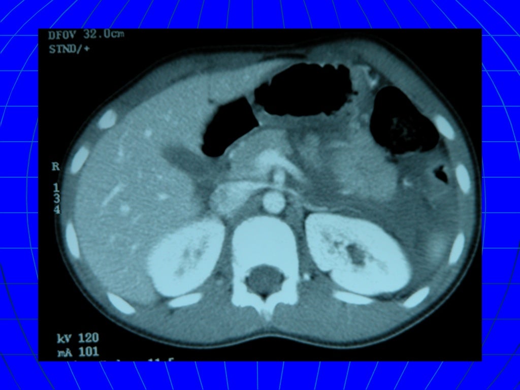 Blunt trauma thesis 07 image