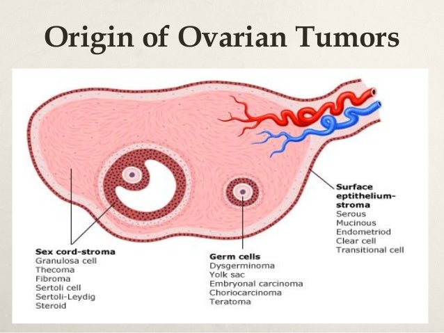 Conservative management of ovarian cancer 14 5-2015