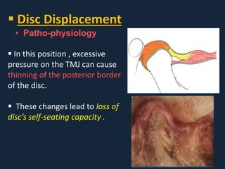 Conservative management of temporomandibular disorders | PDF