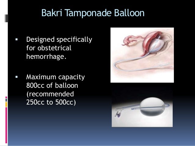 conservative mx of pph bakri balloon
