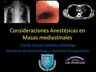 Consideraciones Anestésicas en
Masas mediastinales
Carlos Arturo Sánchez Montoya
Residente de Anestesiología y Medicina Perioperatoria
Clínica
Las Américas
 