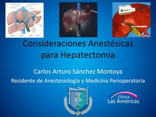 Consideraciones Anestésicas
para Hepatectomia
Carlos Arturo Sánchez Montoya
Residente de Anestesiología y Medicina Perioperatoria
Clínica
Las Américas
 