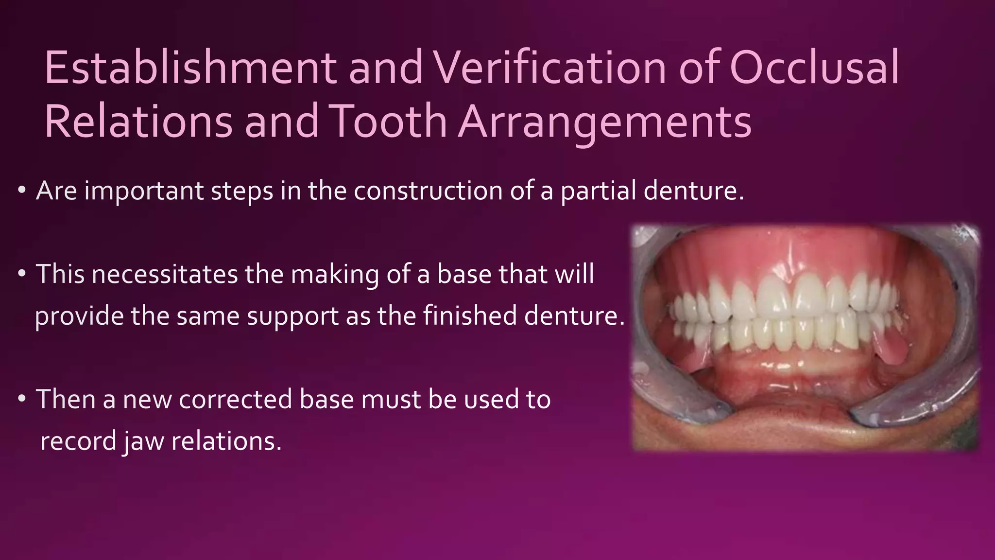 Establishment andVerification of Occlusal
Relations andTooth Arrangements
 