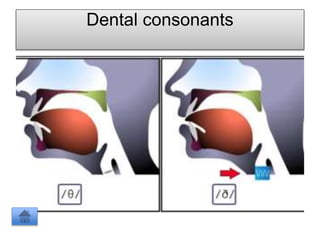 Dental consonants
 