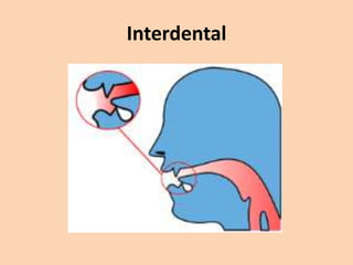 Interdental

 