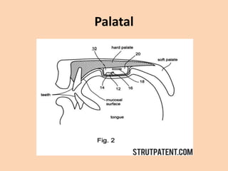 Palatal

 