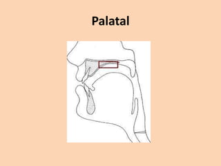 Palatal

 