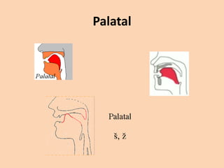 Palatal

 