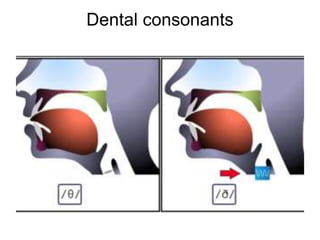 Dental consonants
 