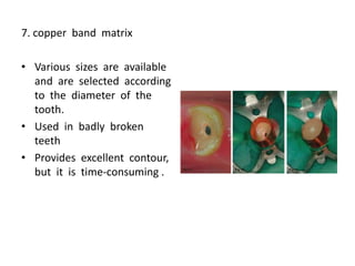 7. copper band matrix
• Various sizes are available
and are selected according
to the diameter of the
tooth.
• Used in badly broken
teeth
• Provides excellent contour,
but it is time-consuming .
 