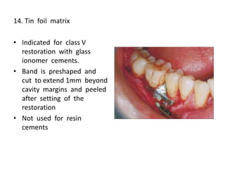 14. Tin foil matrix
• Indicated for class V
restoration with glass
ionomer cements.
• Band is preshaped and
cut to extend 1mm beyond
cavity margins and peeled
after setting of the
restoration
• Not used for resin
cements
 