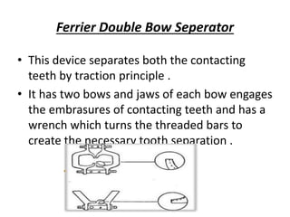 Ferrier Double Bow Seperator
• This device separates both the contacting
teeth by traction principle .
• It has two bows and jaws of each bow engages
the embrasures of contacting teeth and has a
wrench which turns the threaded bars to
create the necessary tooth separation .
 
