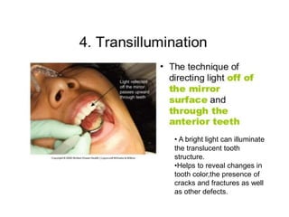 • A bright light can illuminate
the translucent tooth
structure.
•Helps to reveal changes in
tooth color,the presence of
cracks and fractures as well
as other defects.
 