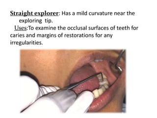 Straight explorer: Has a mild curvature near the
exploring tip.
Uses:To examine the occlusal surfaces of teeth for
caries and margins of restorations for any
irregularities.
 