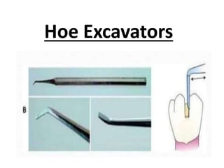 Hoe Excavators
 