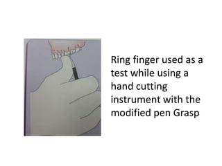 Ring finger used as a
test while using a
hand cutting
instrument with the
modified pen Grasp
 