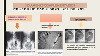 Evalúa disfunción del piso
pelviano
PRUEBA DE EXPULSION DEL BALON
DEFECOGRAFÍA
Útil cuando hay síntomas subjetivos de
disfunción del piso pelviano o si la
prueba de expulsión de balón +
ESTUDIO DE TIEMPO DE
TRANSITO COLORRECTAL
Descargado por DANNA PAREDES (dlparedes@ucvvirtual.edu.pe)
Encuentra más documentos en www.udocz.com
 