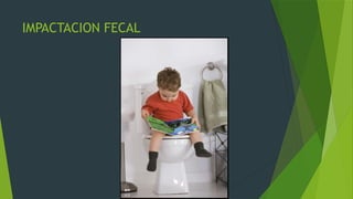 IMPACTACION FECAL
 
