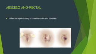 ABSCESO ANO-RECTAL
 Suelen ser superficiales y su tratamiento incision y drenaje.
 