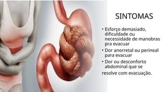 SINTOMAS
• Esforço demasiado,
dificuldade ou
necessidade de manobras
pra evacuar
• Dor anorretal ou perineal
para evacuar
• Dor ou desconforto
abdominal que se
resolve com evacuação.
 