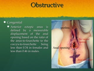 OObbssttrruuccttiivvee 
CCoonnggeenniittaall 
AAnntteerriioorr eeccttooppiicc aannuuss iiss 
ddeeffiinneedd bbyy aa mmeeaassuurraabbllee 
ddiissppllaacceemmeenntt ooff tthhee aannaall 
ooppeenniinngg bbaasseedd oonn tthhee rraattiioo ooff 
tthhee aannuuss--ttoo--ffoouurrcchheettttee ttoo tthhee 
ccooccccyyxx--ttoo--ffoouurrcchheettttee bbeeiinngg 
lleessss tthhaann 00..3344 iinn ffeemmaalleess aanndd 
lleessss tthhaann 00..4466 iinn mmaalleess.. 
Anal opening 
Anal sphincter 
urethra 
No vaginal 
opening 
 