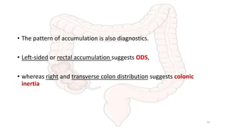 • The pattern of accumulation is also diagnostics.
• Left-sided or rectal accumulation suggests ODS,
• whereas right and transverse colon distribution suggests colonic
inertia
33
 