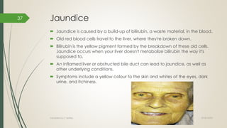 Jaundice
 Jaundice is caused by a build-up of bilirubin, a waste material, in the blood.
 Old red blood cells travel to the liver, where they're broken down.
 Bilirubin is the yellow pigment formed by the breakdown of these old cells.
Jaundice occurs when your liver doesn't metabolize bilirubin the way it's
supposed to.
 An inflamed liver or obstructed bile duct can lead to jaundice, as well as
other underlying conditions.
 Symptoms include a yellow colour to the skin and whites of the eyes, dark
urine, and itchiness.
2018/10/02Compiled by C Settley
37
 
