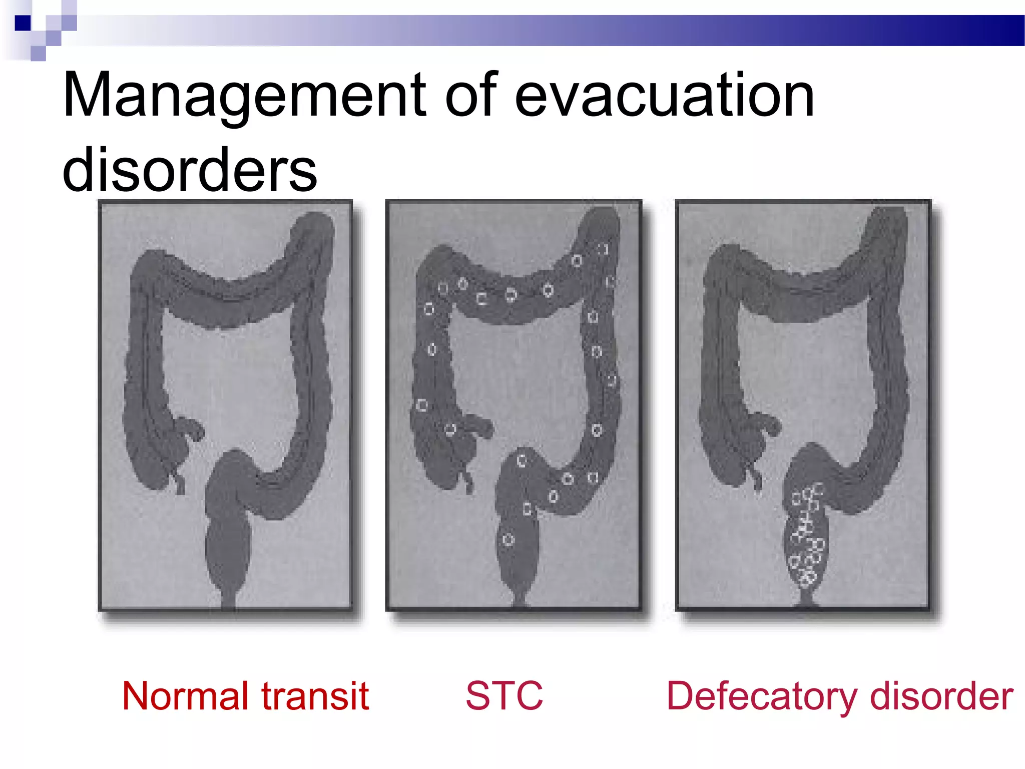 Management of evacuation
disorders
STC Defecatory disorderNormal transit
 