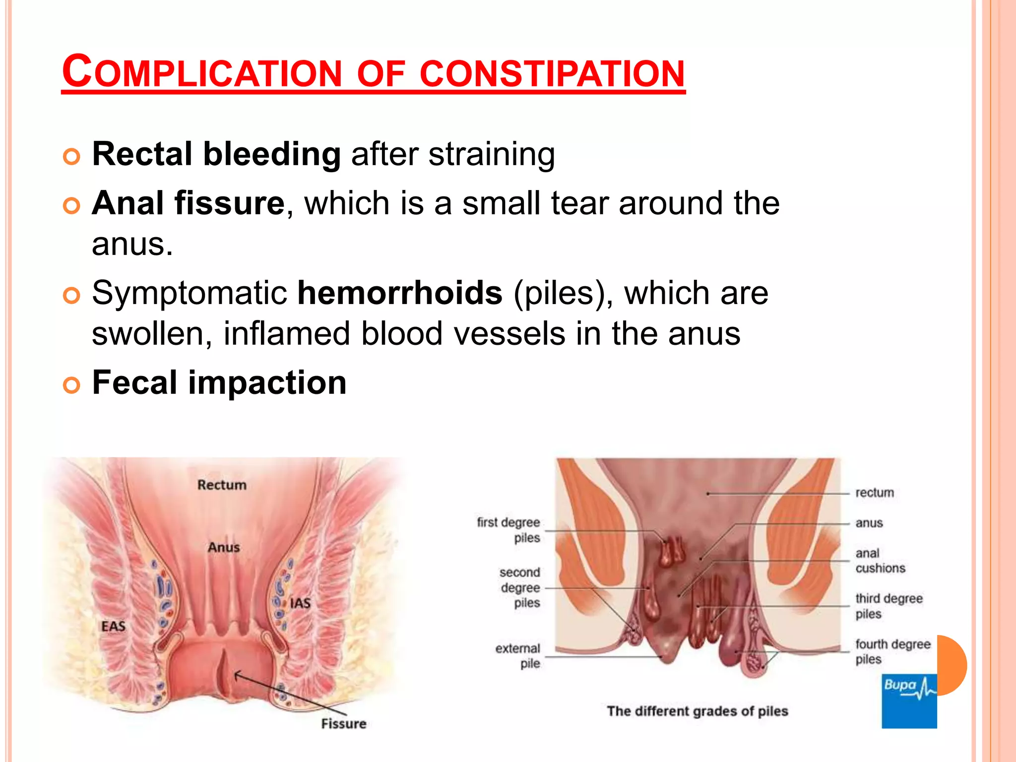 Constipation With Overflow Constipation & Diarrhea nursing care | PPTX