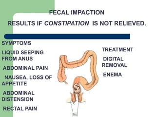 Constipation | PPT