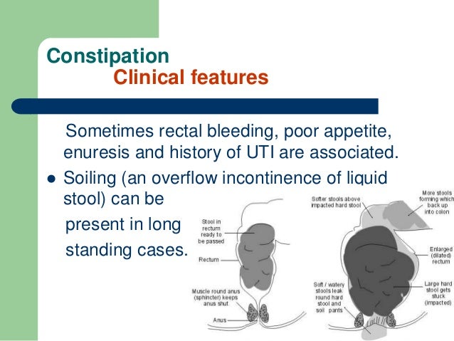 constipation overflow diarrhea