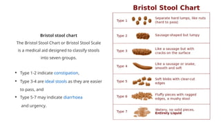 Constipation for undergraduate medical students.pptx