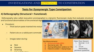 Comprehensive Guide to Constipation: Evaluation, Classification, and ...
