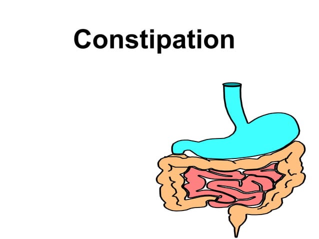 Constipation | PPTX | Digestive Disorders | Diseases and Conditions