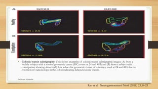 Constipation | PPTX