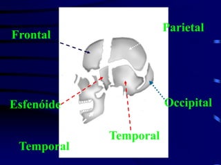 Frontal
Parietal
Temporal
Occipital
Temporal
Esfenóide
 