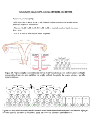 PAPILOMAVÍRUS HUMANO (HPV), VERRUGAS E CÂNCER DO COLO DO ÚTERO
Papilomavírus humano (HPV) :
-Baixo risco (6, 11, 42, 43, 44, 45, 51, 52, 74 ...) Causam tumores benignos como verrugas comuns
e verrugas anogenitais (condilomas)
- Alto risco (16, 18, 31, 33, 35, 39, 45, 51, 52, 56, 58 ...) Associado ao câncer da cérvice, vulva,
ânus e pênis
- Mais de 40 tipos de HPVs infectam o trato anogenital
 
