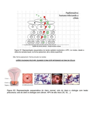 Obs: forma epissomal = forma circular no núcleo
LESÕES CAUSADAS PELO HPV, QUANDO O DNA ESTÁ INTEGRADO AO DNA DA CÉLULA
 