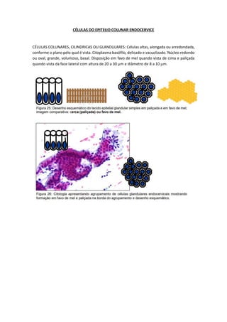 CÉLULAS DO EPITELIO COLUNAR ENDOCERVICE
CÉLULAS COLUNARES, CILINDRICAS OU GLANDULARES: Células altas, alongada ou arredondada,
conforme o plano pelo qual é vista. Citoplasma basófilo, delicado e vacuolizado. Núcleo redondo
ou oval, grande, volumoso, basal. Disposição em favo de mel quando vista de cima e paliçada
quando vista da face lateral com altura de 20 a 30 m e diâmetro de 8 a 10 m.
 