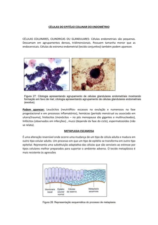 CÉLULAS DO EPITÉLIO COLUNAR DO ENDOMÉTRIO
CÉLULAS COLUNARES, CILINDRICAS OU GLANDULARES- Células endometriais são pequenas.
Descamam em agrupamentos densos, tridimensionais. Possuem tamanha menor que as
endocervicais. Células do estroma endometrial (tecido conjuntivo) também podem aparecer.
Podem aparecer: Leucócitos (neutrófilos- escassos na ovulação e numerosos na fase
progestacional e em processos inflamatórios), hemácias (período menstrual ou associado em
ulcera/trauma), histiocitos (monócitos – no pós menopausa são gigantes e multinucleados),
linfócitos (observados em infecções) , muco (depende da fase do ciclo), espermatozoides (não
se relata).
METAPLASIA ESCAMOSA
É uma alteração reversível onde ocorre uma mudança de um tipo de célula adulta e madura em
outro tipo celular adulto. Um processo em que um tipo de epitélio se transforma em outro tipo
epitelial. Representa uma substituição adaptativa das células que são sensíveis ao estresse por
tipos celulares melhor preparados para suportar o ambiente adverso. O tecido metaplásico é
mais resistente às agressões
 