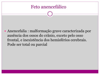 Feto anencefálico
 Anencefalia : malformação grave caracterizada por
ausência dos ossos do crânio, exceto pelo osso
frontal, e inexistência dos hemisférios cerebrais.
Pode ser total ou parcial
 