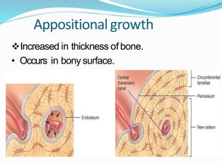Appositionalgrowth
Increased in thickness of bone.
• Occurs in bony surface.
 