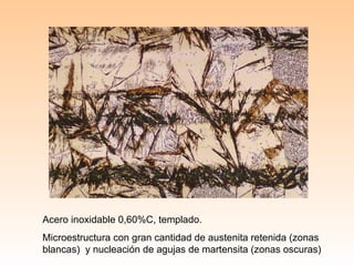 Acero inoxidable 0,60%C, templado. Microestructura con gran cantidad de austenita retenida (zonas blancas)  y nucleación de agujas de martensita (zonas oscuras) 