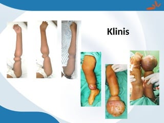 Klinis
 