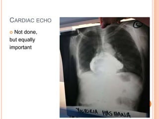 CARDIAC ECHO
 Not done,
but equally
important
 