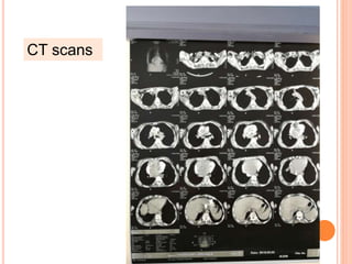 CT scans
 